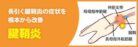 腱鞘炎